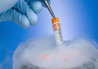 试管婴儿（IVF- ET）